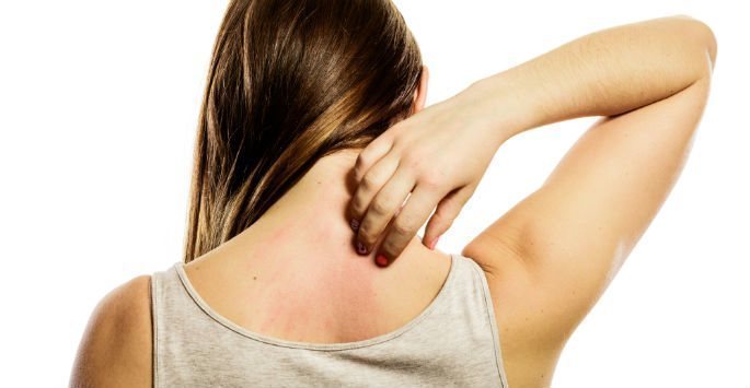 Cómo saber si eres alérgica a algo