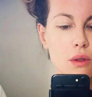 Prepucios de bebés coreanos como tratamiento antiaging