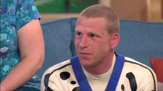 La extraña afición de un hombre que vive como si fuera un dálmata 