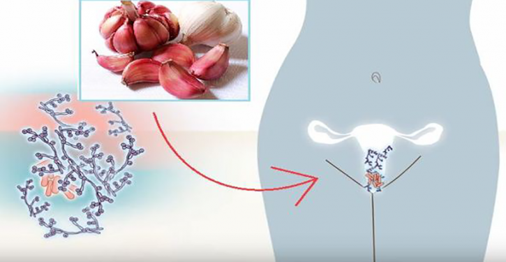 La verdadera razón por la que las mujeres se meten ajos en la vagina 