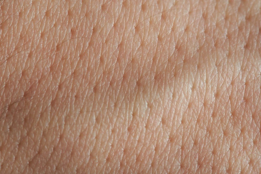 Poros en la cara Poros en la cara