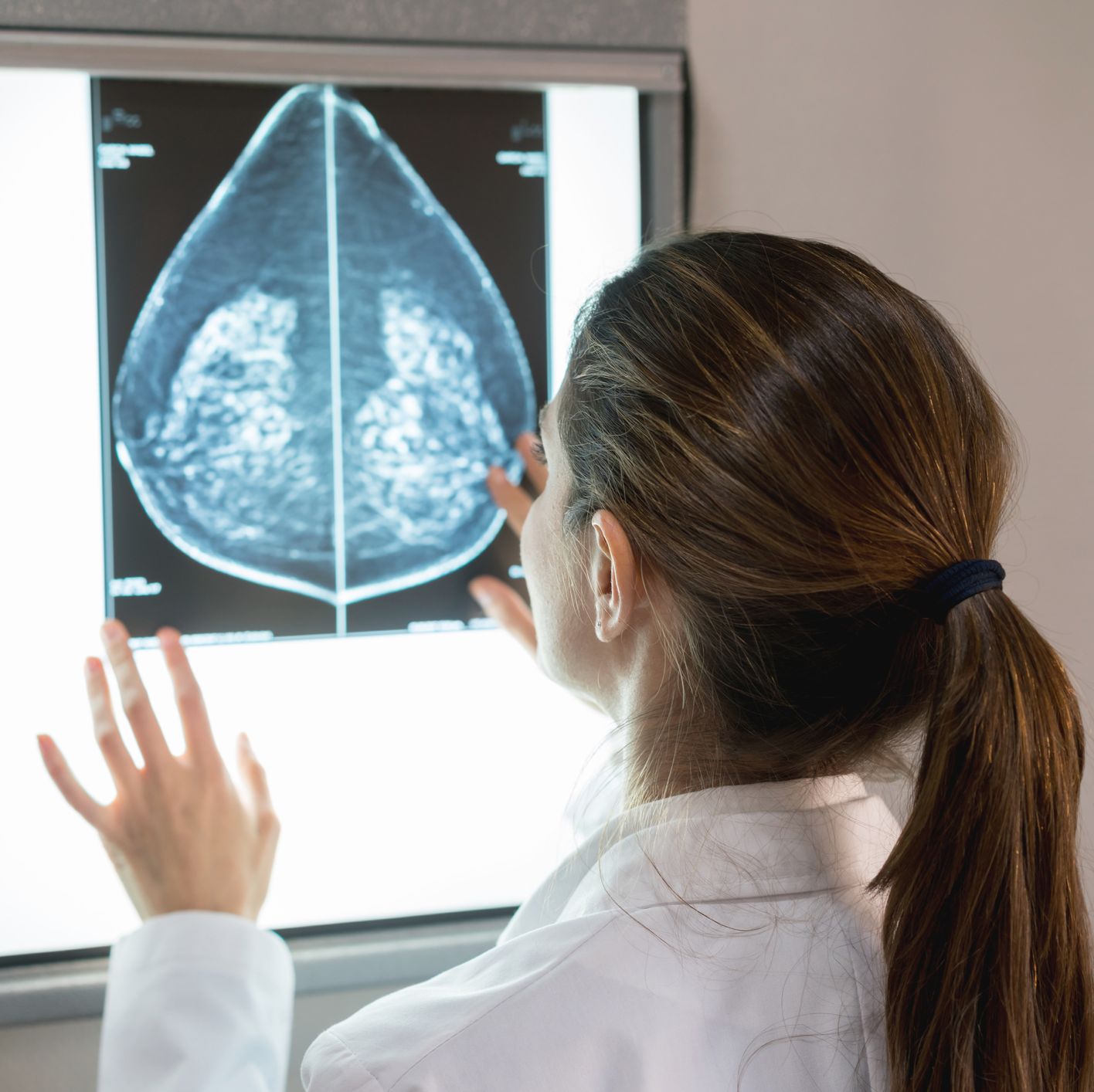 unrecognizable female gynocologist looking at a mammogram at the hospital