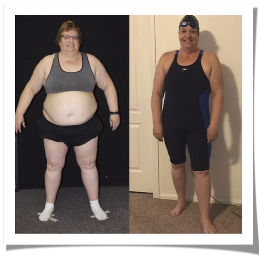 5 mitos comunes sobre la artritis reumatoide Es hora de dejar de creer