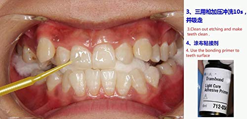 1 Kit OrthoForce® Bricolaje Adhesivo Ortodoncia Dental Cemento Dental Metal Brace