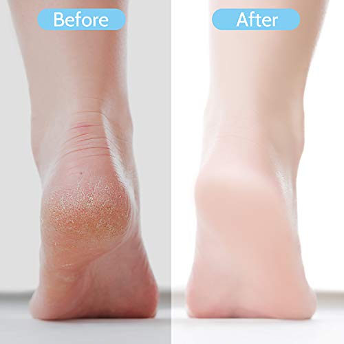 15 Pcs Juego de Herramientas de Pedicura Profesional, Acero Inoxidable Lima de Pies, Escofina de Pedicura Removedor de Piel Muerta Set, Cuidado del Pies para Hombre Mujer