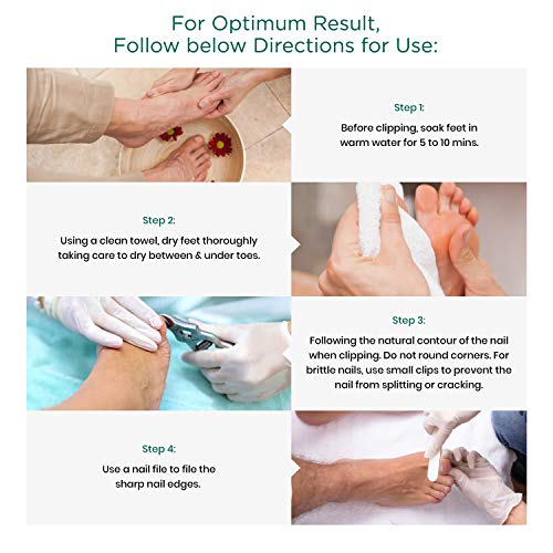 Alicate Cortauñas Blizzard - 13 cm, Corte Extra Delgado Uñas Encarnadas - Acero Inoxidable Forjado Alemán - Pedicura Podología Profesional - Dispositivo Médicos, Marcado CE