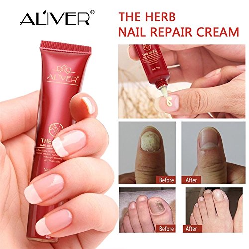 Aliver Hierba - Crema de solución de infección de uñas anti hongos potente y premium para eliminar y matar hongos en las uñas para uñas de pies y uñas - efectiva contra el 99.9% de hongos en las uñas.