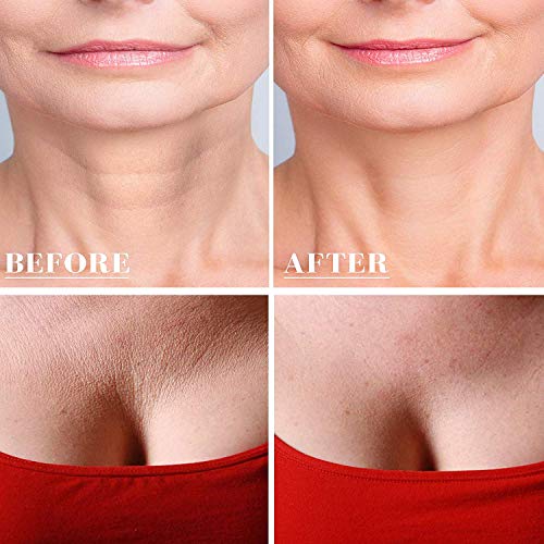 Almohadilla de silicona para el pecho, reutilizable, antiarrugas, para el pecho, cuello, se puede lavar para evitar arrugas, hidratante, mantener la piel suave (forma de T)