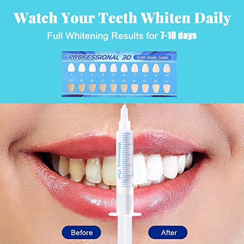 Blanqueador Dental Profesional OriHea Carga magnética con 16 luces LED, jeringas de gel para blanquear los dientes de 5 ml (paquete de 4), jeringas de gel desensibilizante (paquete de 1)