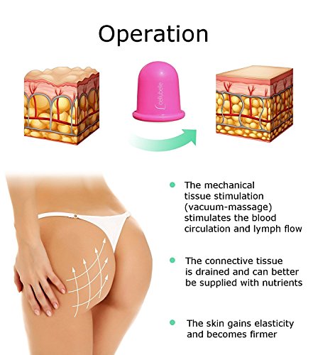 Cellubelle - La ventosa anti-celulitis para prevenir y combatir la celulitis y piel de naranja (Fuchsia / rosa)