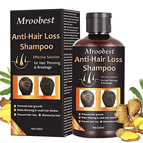 Champú, Champú antipérdida de cabello, ayuda a detener la pérdida de cabello, crecimiento rápido del cabello, tratamiento para la pérdida de cabello para hombres y mujeres (220 ml)
