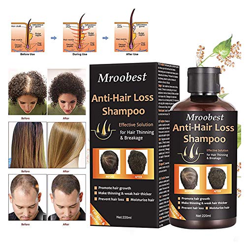 Champú, Champú antipérdida de cabello, ayuda a detener la pérdida de cabello, crecimiento rápido del cabello, tratamiento para la pérdida de cabello para hombres y mujeres (220 ml)