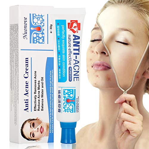 Crema Antiacne, Acné Crema, Acne Tratamiento, Reducir los Puntos negros, Equilibrar el Agua y el Aceite, la Crema Contra el Acné Espinilla Regenera la piel, 30 g