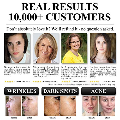 Crema Correctoras y Anti-Imperfecciones - La Mejor Crema Faciales Mujer Hidratante, Antiarrugas, Antimanchas | Crema Hidratante para la cara | Reafirmante, Nutre y Repara - 50 ml | 100% Garantía