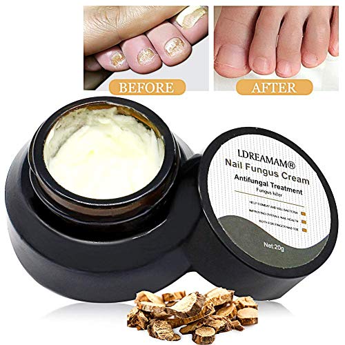 Crema de uñas para pies Crema para el cuidado de la piel Crema de hongos para uñas Crema anti hongos para reparar las uñas