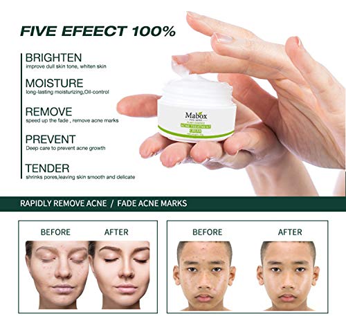 Crema facial de Hierbas Naturales. Remedio natural y eficaz para el acné, psoriasis, eccemas y procesos inflamatorios e infecciosos del rostro. 20gr