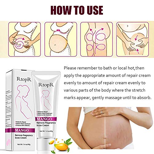 Crema para estrías, Eliminar cicatrices del embarazo, Tratamiento de las estrías, Reparación de maternidad, Eliminar estrías del embarazo,40g