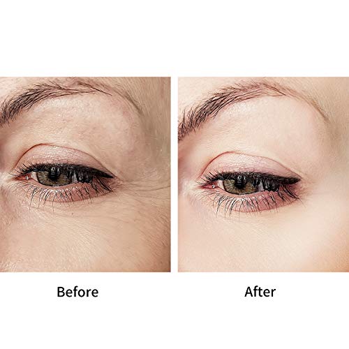 Crema para los Ojos de Retinol de D.obsessed - Resolución antiedad para arrugas, círculos oscuros e hinchazón - Exclusivo con retinol, células madre vegetales, Matrixyl 3000, ácido hialurónico (20g)