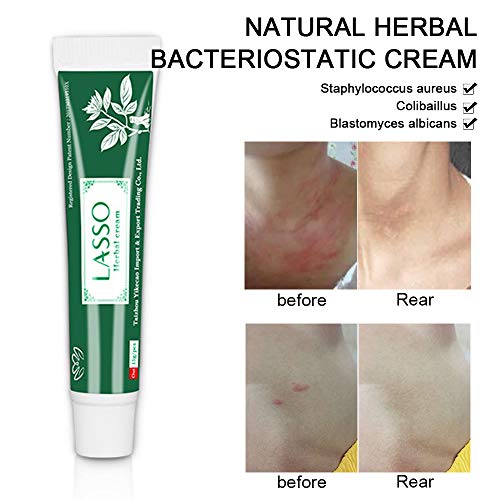 Damaila Eczema Rosacea Dermatitis Psoriasis Tratamiento Crema Gel, 15ml