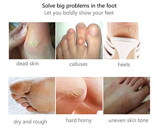 Damaila Efero Foot Peel Mask, 1 par de mascarilla blanqueadora suave y lisa para pies, reparación de mascarillas exfoliantes para pies Rough Repair