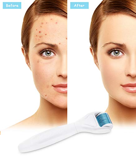 Dermaroller, Winpok 6 en 1 Derma Roller, Derma roller, Ideal para tratar cara, Anti-Edad, Antiarrugas, rodillo facial titanio, por Ojos, Cara, Cuerpo (azul)