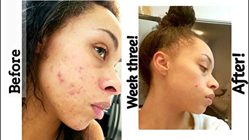 Emulsión de retinol de The Ordinary, 30 ml, 1%