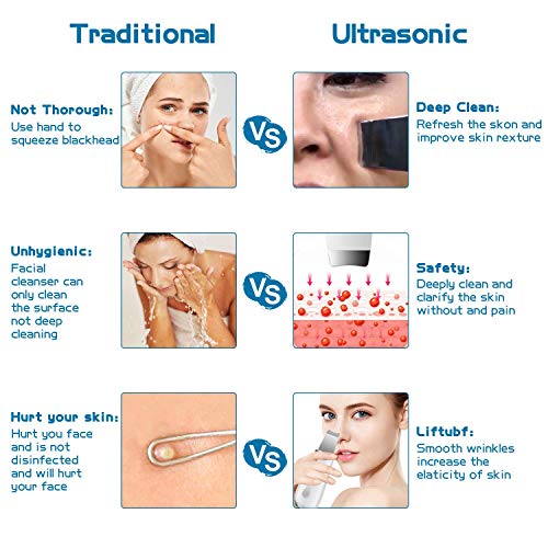 Espátula depuradora de Piel, Limpiador de poros con 3 Engranajes, espátula depuradora Facial, Extractor de Comedones para Limpieza Profunda Facial,Blanco