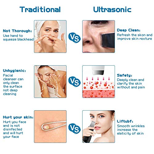 Espátula depuradora de Piel, Limpiador de poros con 3 Engranajes, espátula depuradora Facial, Extractor de Comedones para Limpieza Profunda Facial,Negro