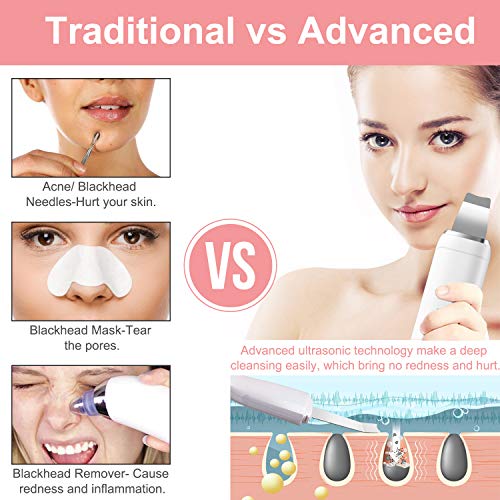 fayleer Peeling Ultrasónico Facial Limpiador Facial Ultrasónica Espátula Ultrasónica Skin Scrubber Exfoliación Limpiador de Poros para Limpieza Facial y Cuidado Facial