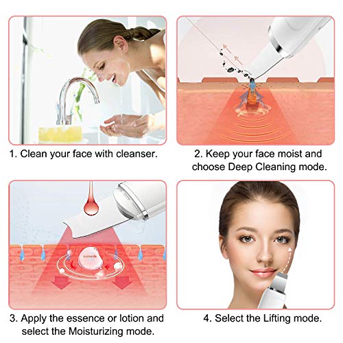 fayleer Peeling Ultrasónico Facial Limpiador Facial Ultrasónica Espátula Ultrasónica Skin Scrubber Exfoliación Limpiador de Poros para Limpieza Facial y Cuidado Facial