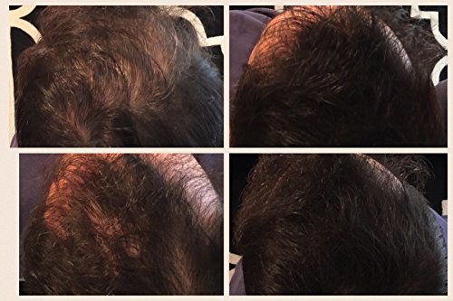 Fibras espesantes para el cabello LUXE con queratina natural - ¡Tratamiento para 2 meses! - Probado por dermatólogos - Hipoalergénico - Multiples colores disponibles. Marrón medio
