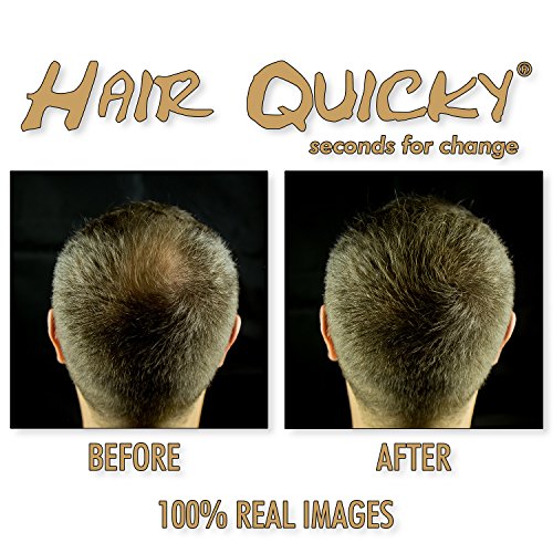 Hair Quicky® Premium Hair Fibers, fibras de pelo, construcción de pelo espesante de cabello, en caso de alopecia calvicie caída del pelo o cabello ralo, natural queratina | 28g | negro