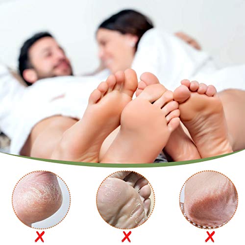 Janolia 2pcs Mascarilla de Pies, Exfoliante Pies, Foot Mask Eliminar Córnea y Piel Muerta, Hidrata y Mantiene Humedad, Lavanda y Rosa, para Mujeres y Hombres, Embalaje al Azar