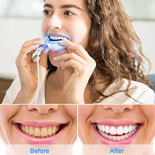 Kit de Blanqueamiento Dental, Blanqueador Dental Profesional Gel Blanqueador de Dientes Para Manchas de Humo, Dientes Negros, Dientes Amarillos-6x4ML Gel,6xBlanqueadores de Dientes, 1xLuz LED
