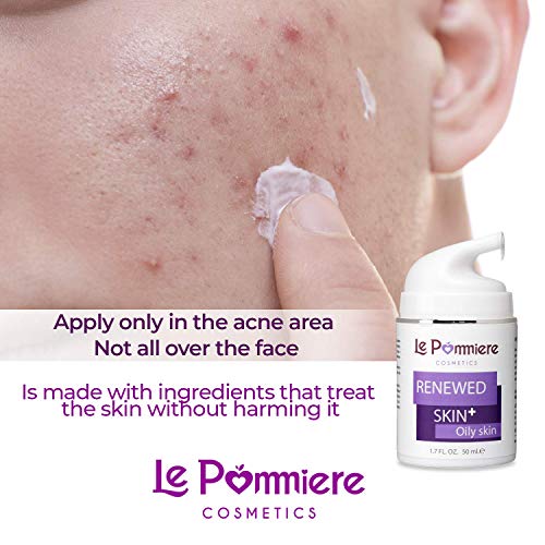 Le Pommiere Tratamiento Acné gel 50ml. Ayuda a remover espinillas, granos en cara o cuerpo. Anti imperfecciones facial y corporal. Adolescente, juvenil, hormonal o quístico