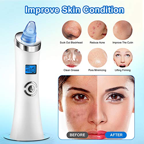 Limpiador de Poros, 6-In-1 Electrico Extractor Punto Negros Removedor de Espinillas, Quitar Puntos Negros 5 Niveles Ajustable con USB Carga Portátil Eliminador de Espinillas y Acné…