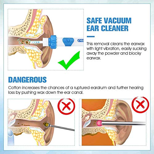 Limpieza Cerumen Oído, Eliminar Quitar cera oidos, Kit Limpiador para Oídos, Limpiador de Cera de Oídos, Limpiador De Oidos, Limpieza De OíDos, para bebés, jóvenes y adolescentes adultos