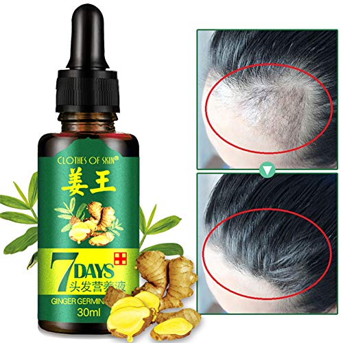 Lucoss Crecimiento de Cabello,Tratamiento para el Cabello, Aceite para el Crecimiento de Pelo,Serum de Cabello, Estimula el Crecimiento de Pelo para Hombre y Mujer