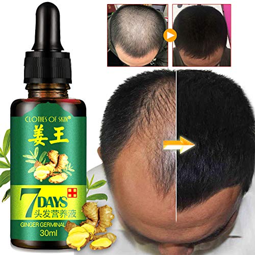 Lucoss Crecimiento de Cabello,Tratamiento para el Cabello, Aceite para el Crecimiento de Pelo,Serum de Cabello, Estimula el Crecimiento de Pelo para Hombre y Mujer