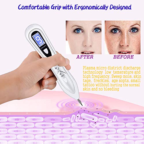 Manchas Cara Eliminación, BUDDYGO Skin Tag Mole Removal Pen Intensidad de 9 Niveles para Cara y Cuerpo (Verrugas, Nevus, Tatuajes, Pecas, Manchas) con LCD y Agujas Reemplazables, Seguro y Eficiente