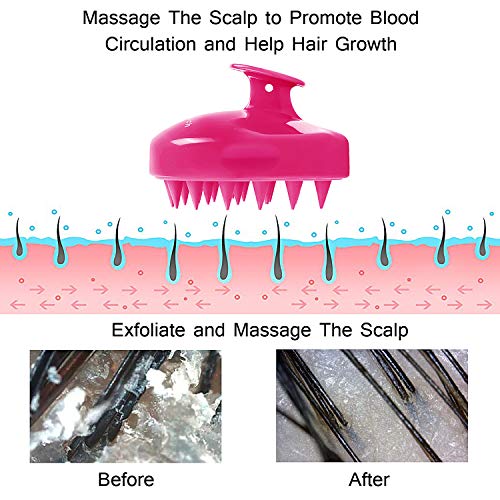 Masajeador Cuero Cabelludo, FReatech [Mojado & Seco] Masajeador Cabeza, Cepillo Pelo de Champú de Silicona Limpia las Raíces Pelo, Exfolia y Elimina Caspa, Promover Crecimiento del Pelo - Rojo