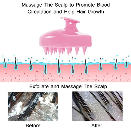 Masajeador Cuero Cabelludo, FReatech [Mojado & Seco] Masajeador Cabeza, Cepillo Pelo de Champú de Silicona Limpia las Raíces Pelo, Exfolia y Elimina Caspa, Promover Crecimiento del Pelo - Rojo