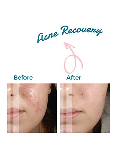 Mascarilla de arcilla rosa de Sun Prive; purifica de la piel, tonifica y refina, para recuperación de acné, elimina punto negros, efecto purificador; fórmula australiana