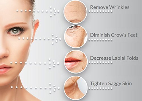 NUEVO Dermaroller Kit 3 en 1 Para la Cara y el Cuerpo - Disminuir Cicatrices de Acné, Arrugas y Líneas Finas, Hiperpigmentación, Celulitis & Estrías