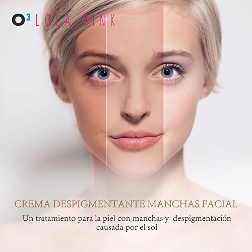 O³ Crema Antimanchas Facial – 2 Unidades x 30 g – Cosmética Anti-Manchas | Despigmentante Facial Para La Cara – Crema Blanqueadora Quita Manchas Facial – Imperfecciones – Marcas De La Piel