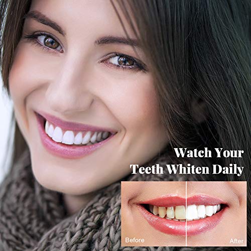 OriHea Kits de blanqueamiento de dientes de luz LED, 5 veces más potente luz LED azul, (8) gel blanqueador de dientes de 3 ml, (2) gel desensibilizador de 3 ml, juego de sonrisa blanca con bandeja de