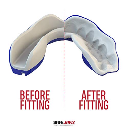 SAFEJAWZ 'Extro Serie' Protector Bucal. para Todos los Deportes de Contacto, incluidos el Rugby, MMA, Las Artes Marciales y el Boxeo. (Tiburón, Adulto (12+ Años))