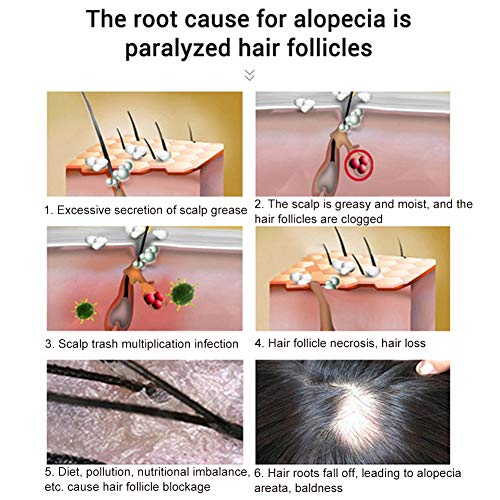 Serum Cabello,Hair Growth Serum,Anticaida Spray,Promote Hair Growth,Preventing Hair Loss and Hair Grwoth Spray Hair Care Hair,Hair Loss Treatment for Men & Women（30ml）