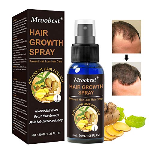 Serum Cabello,Hair Growth Serum,Anticaida Spray,Promote Hair Growth,Preventing Hair Loss and Hair Grwoth Spray Hair Care Hair,Hair Loss Treatment for Men & Women（30ml）