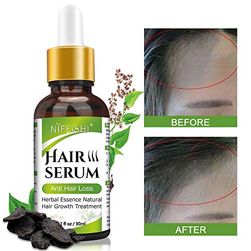 Serum Crecimiento Cabello, Antipérdida de Cabello, para Acelerar el Crecimiento del Cabello, Promueve más Cabello Ticker, más Completo y más Rápido Crecimiento,Crece Pelo para Hombre y Mujer (30ML)